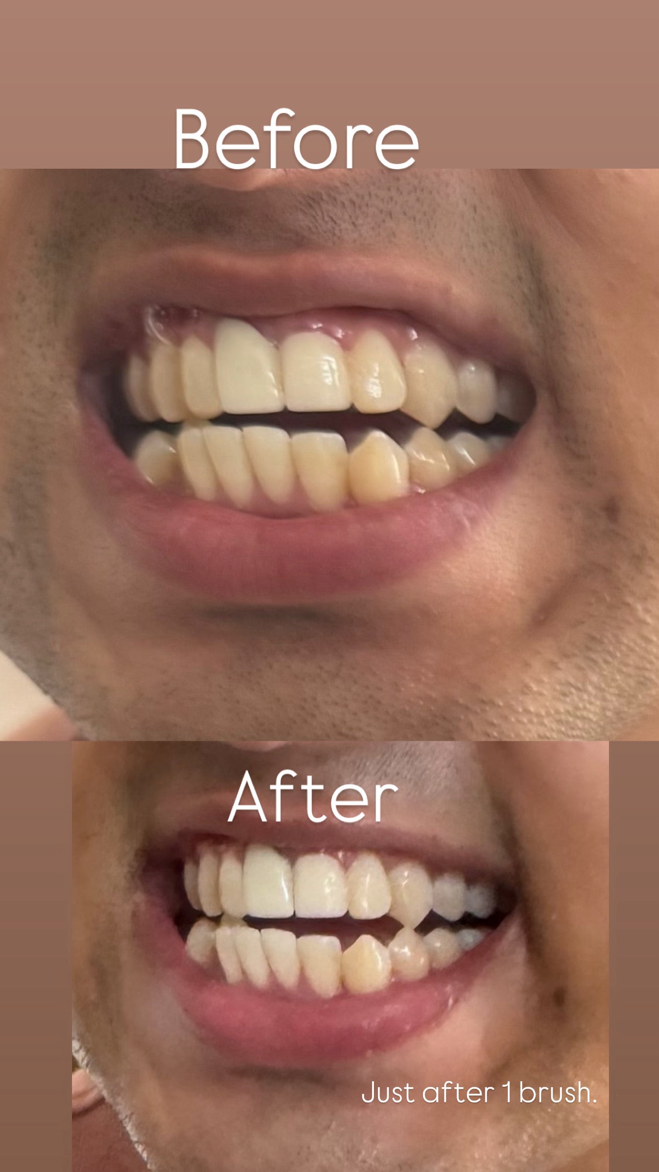 MAD Teeth Whitening Powder