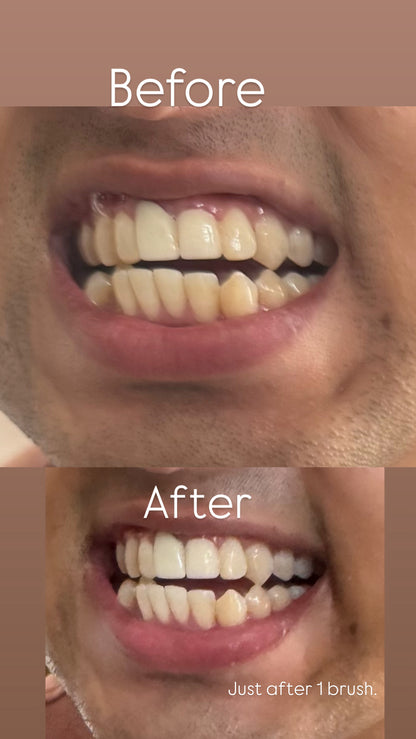 MAD Teeth Whitening Powder